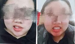 洛阳治疗面神经麻痹案例